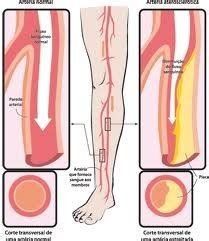 Angiologia i cirurgia vascular